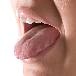 Open Mouth