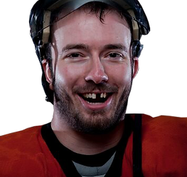 Hockey player with knocked out tooth