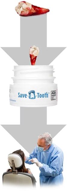 process of how save-a-tooth works